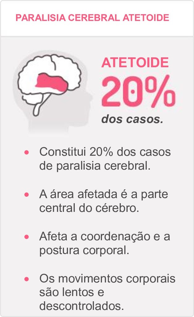 Infográfico sobre paralisia cerebral atetoide, afeta 20% dos casos.