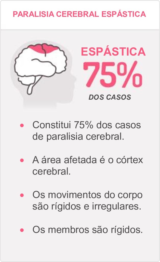 Informações sobre paralisia cerebral espástica: afeta o córtex cerebral e causa rigidez.